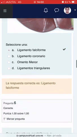 Miniatura del documento EXAMEN-4-ABDOMEN.mp4