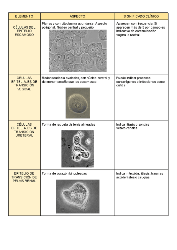 Miniatura del documento TABLA-ELEMENTOS-FORMES-ORINA.pdf