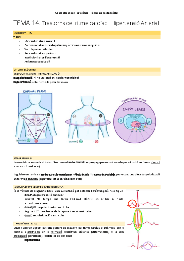 Miniatura del documento TEMA-14Trastorns-del-ritme-cardiac-i-HA.pdf