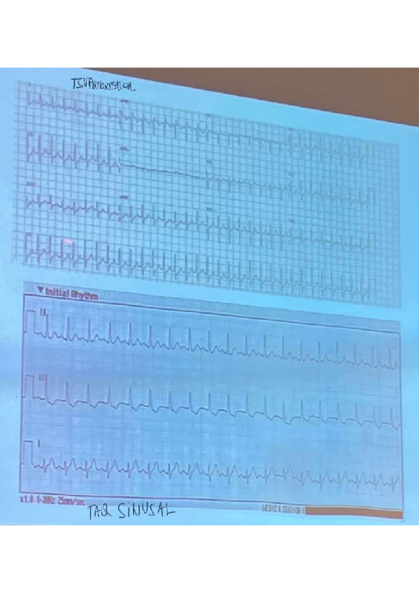 Miniatura del documento TS-Y-TSVP.pdf