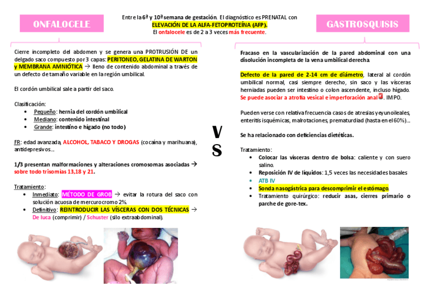 Miniatura del documento ONFALOCELE-VS-GASTROSQUISIS.pdf