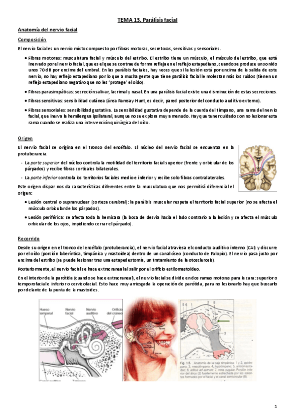 Miniatura del documento Tema 13. Parálisis facial.pdf