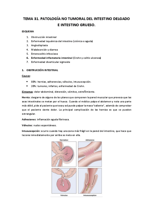 Miniatura del documento Tema 31.pdf