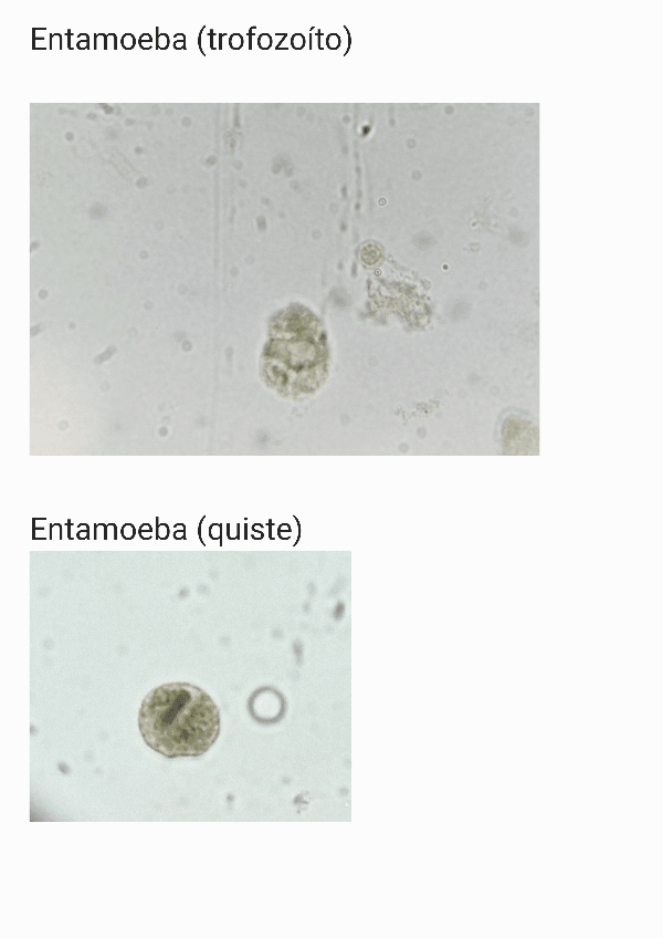 Miniatura del documento Preparaciones microscópicas protozoos.pdf