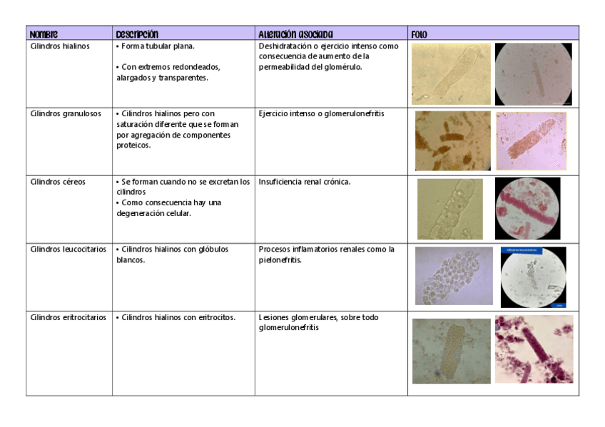 Miniatura del documento tabla-de-cilindros-y-cristales-en-orina.pdf