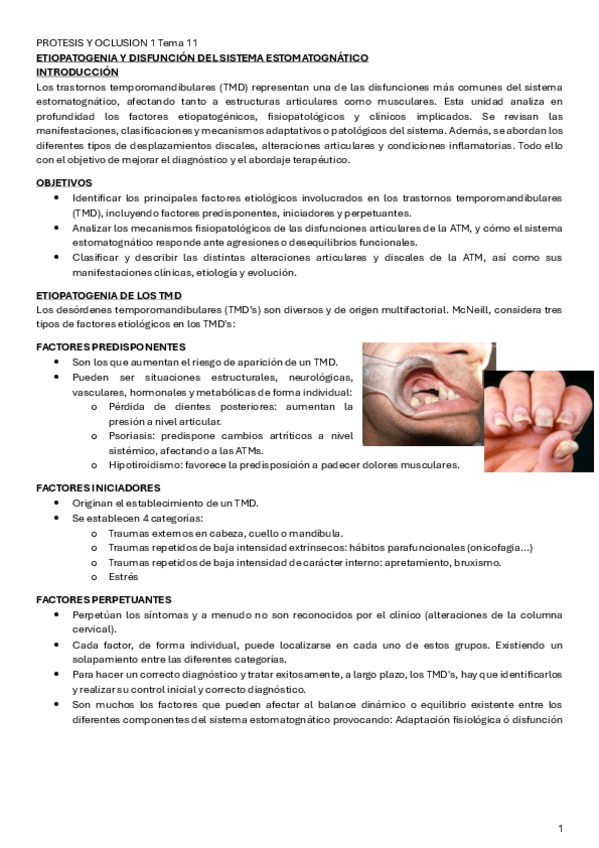 Miniatura del documento PROTESIS-Y-OCLUSION-1-Tema-11.pdf