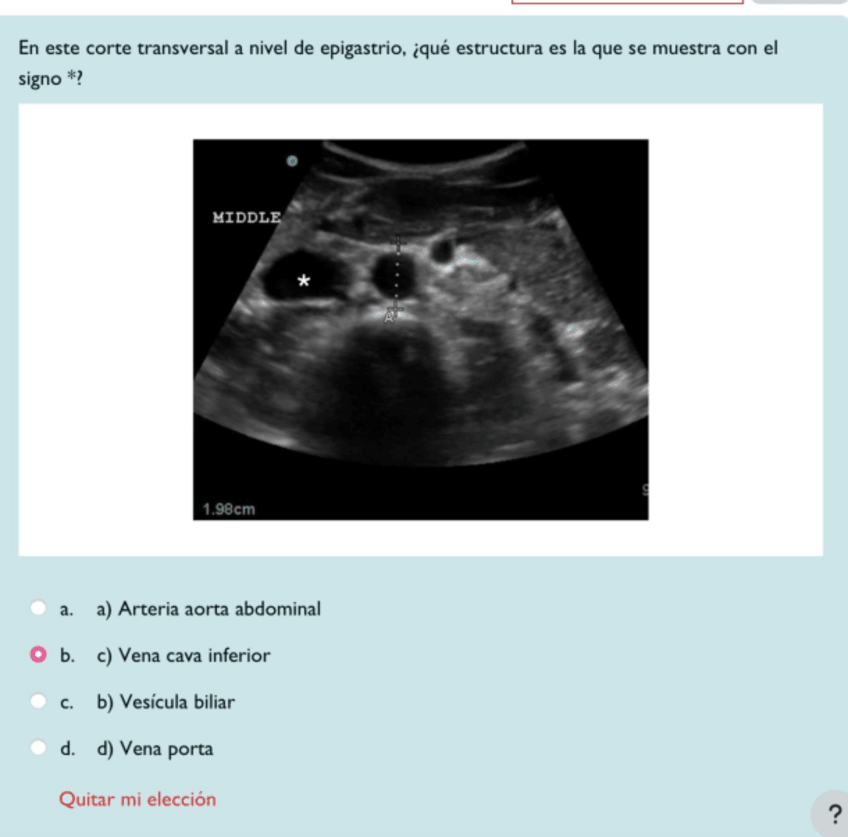 Miniatura del documento evaluacion-ecografia.pdf