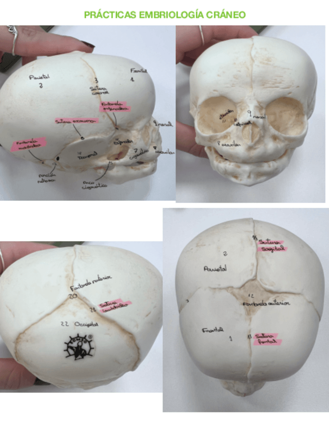 Miniatura del documento Practica-embrio-CRANEO.pdf