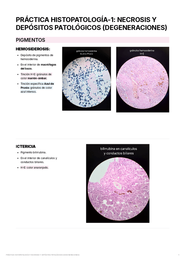 Miniatura del documento PRACTICAHISTOPATOLOGIA-1NECROSISYDEPOSITOSPATOLOGICOSDEGENERACIONES.pdf