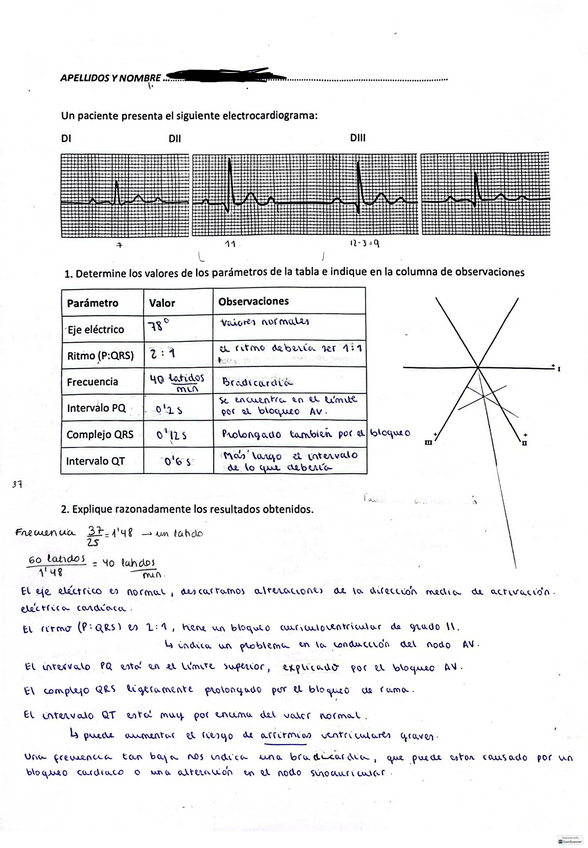 Miniatura del documento EJERCICIO-ECG.pdf