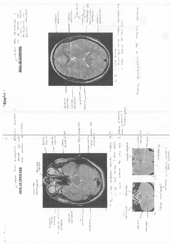 Miniatura del documento imagenes-2n-exam-rellenado.pdf