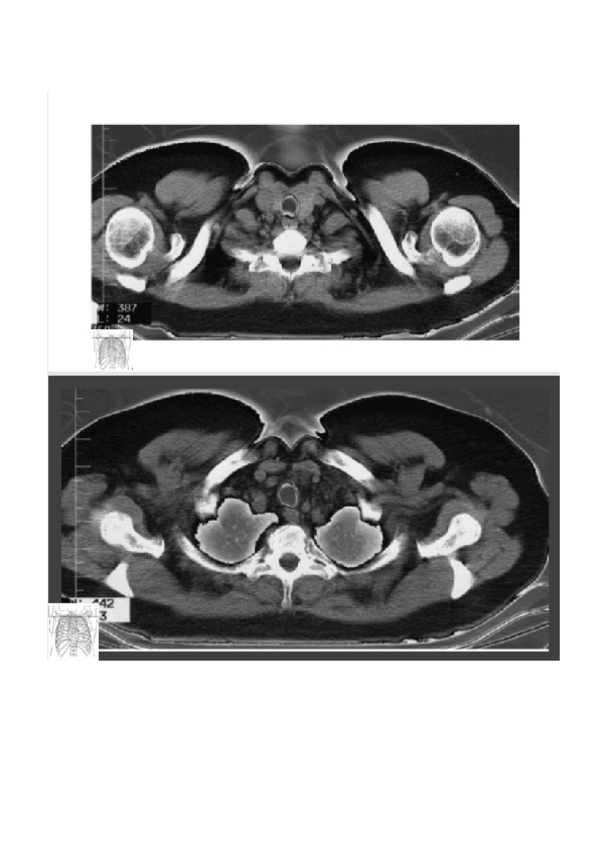 Miniatura del documento TAC-TORAX.docx
