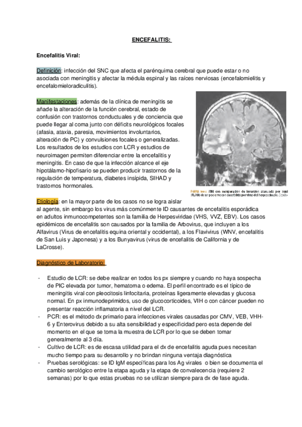 Miniatura del documento ENCEFALITIS.docx